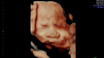 BEBE CLAUDIA 14/02/2024